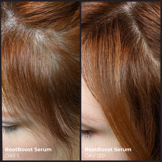 EVOLVh Better Roots RootBoost Serum