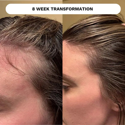 Evatasha | Restore (Hydrating Scalp Tonic) - Essentiallydestinyy